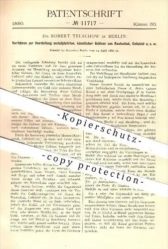 original Patent - Dr. R. Telschow , Berlin , 1880 , metallplatierte Gebisse aus Kautschuk , Celluloid , Medizin , Zähne