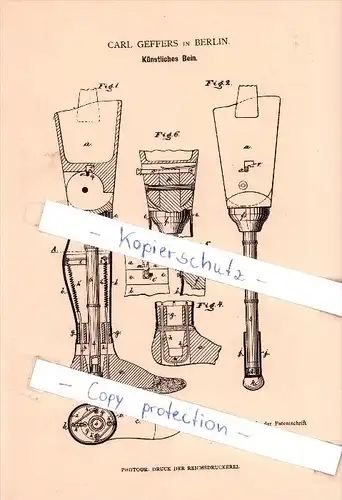 Original Patent   - Carl Geffers in Berlin , 1882 , Künstliches Bein , Orthopädie , Prothese !!!