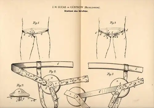 Original Patentschrift - J. H. Lucas in Güstrow i. Mecklenburg , 1890 , Bruchband , Arzt , Operation , Krankenhaus !!!