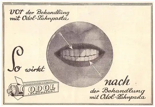 original Werbung - 1928 - ODOL - Zahnpasta !!!