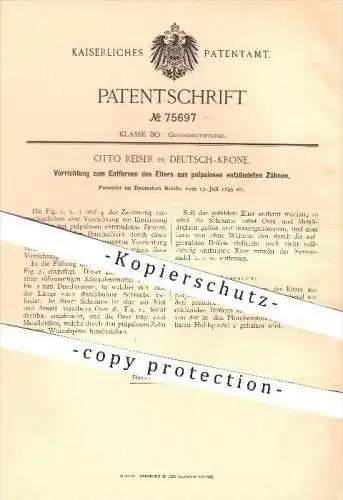 original Patent - Otto Reiser in Deutsch - Krone , 1893 , Entfernen von Eiter aus Zähnen , Zahn , Zähne , Zahnarzt !!!