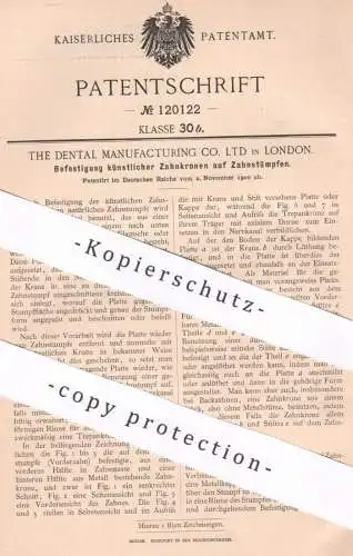 original Patent - The Dental Manufacturing Co. Ltd. , London , England , 1900 , künstliche Zahnkronen | Zahn , Zähne !