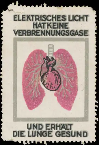 Elektrisches Licht hat keine Verbrennungsgase
