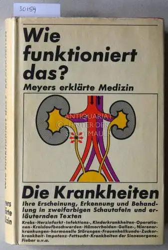 Kunsemüller, Johannes (Red.): Wie funktioniert das? Meyers erklärte Medizin: Die Krankheiten. 