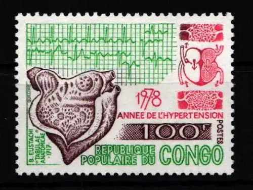 Kongo (Brazzaville) 668 postfrisch #KA277