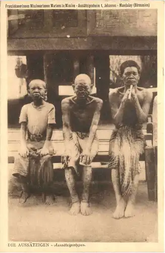 Die Aussätzigen Mandalay- Myanmar -667680