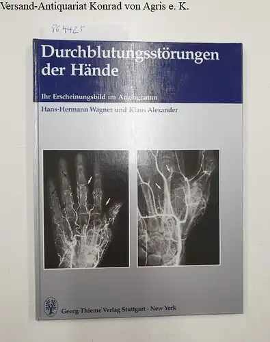 Wagner, Hans-Hermann und Klaus Alexander: Durchblutungsstörungen der Hände
 Ihr Erscheinungsbild im Angiogramm. 
