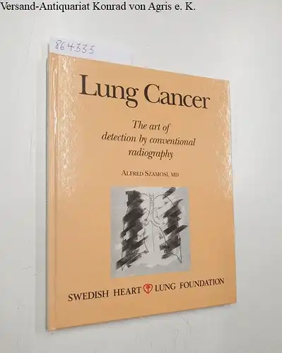 Szamosi, Alfred: Lung Cancer
 The Art of Detection by Conventional Radiography. 