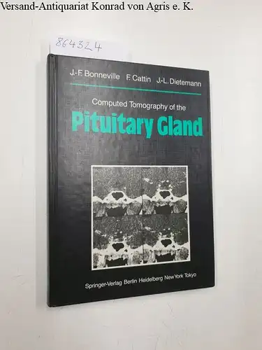 Bonneville, Jean-Francois, F. Cattin and Jean-Louis Dietemann: Computed Tomography of the Pituitary Gland
 With a Chapter on Magnetic Resonance Imaging of the Sellar and Juxtasellar Region, By M. Mu Huo Teng and K. Sartor (English Edition). 