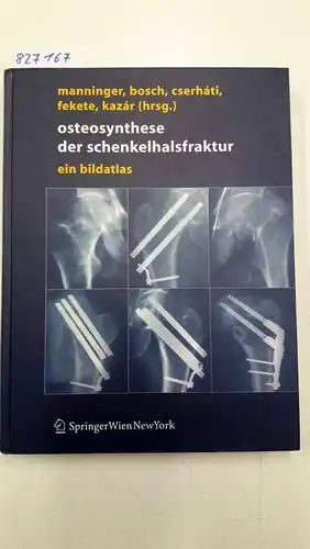 Manninger [Hrsg.], Jenö, Ulrich Bosch [Hrsg.] und Peter Cserhati [Hrsg.]: Osteosynthese der Schenkelhalsfraktur. 