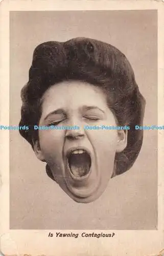 R408191 Is Yawning Contagious A and G Taylor Orthochrome Series 1911