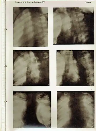 Fortschritte auf dem Gebiete der Röntgenstrahlen
 Band 16: 1910-1911. 