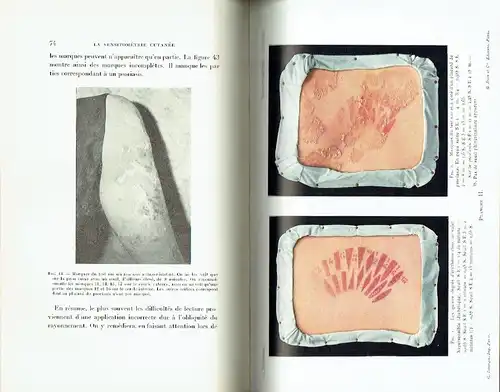 J. Saidman: Introduction a l'Actinothérapie Rationelle la Sensitométrie Cutanée. 