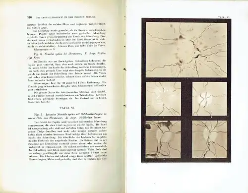 W. R. Gowers: Die Ophthalmoskopie in der inneren Medizin
 Ein Handbuch und Atlas. 