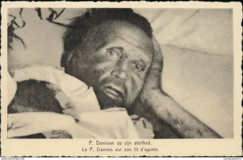 A5870 Belgique peres des Sacres Coeurs P. Damiaan maladie lepreux
