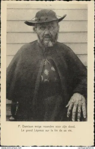 A5870 Belgique peres des Sacres Coeurs P. Damiaan maladie lepreux