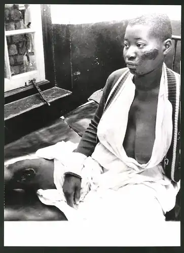 Fotografie Ansicht Wum / Kamerun, verwundete der Vulkankatastrophe am Nyos-See 1986 im Krankenhaus