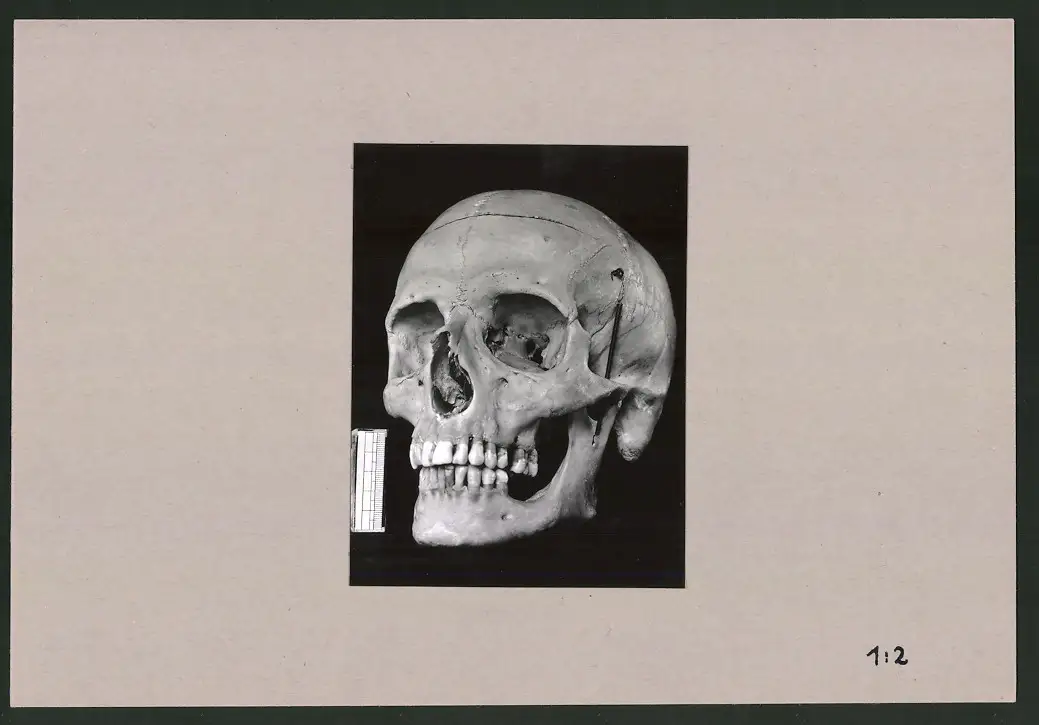 Fotoalbum 28 Privat-Fotografien, Johanna Häcker, Anatomie und Mikrofotografie, Totenkopf, Memento mori 0