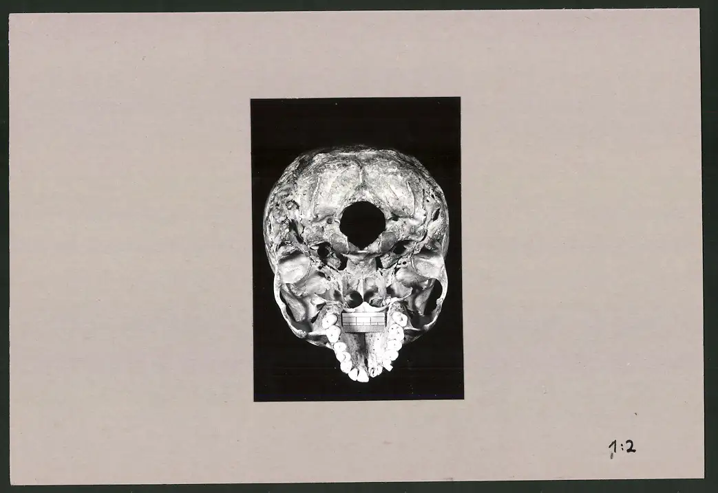 Fotoalbum 28 Privat-Fotografien, Johanna Häcker, Anatomie und Mikrofotografie, Totenkopf, Memento mori 1