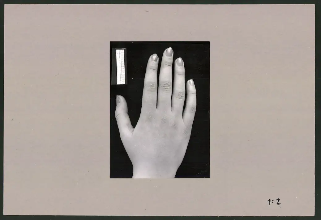 Fotoalbum 28 Privat-Fotografien, Johanna Häcker, Anatomie und Mikrofotografie, Totenkopf, Memento mori 10