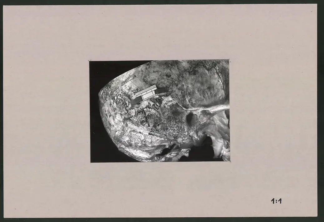 Fotoalbum 28 Privat-Fotografien, Johanna Häcker, Anatomie und Mikrofotografie, Totenkopf, Memento mori 4