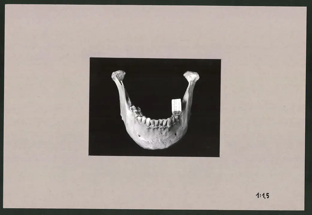 Fotoalbum 28 Privat-Fotografien, Johanna Häcker, Anatomie und Mikrofotografie, Totenkopf, Memento mori 5
