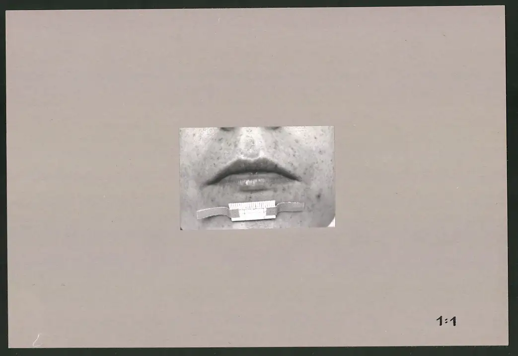 Fotoalbum 28 Privat-Fotografien, Johanna Häcker, Anatomie und Mikrofotografie, Totenkopf, Memento mori 8