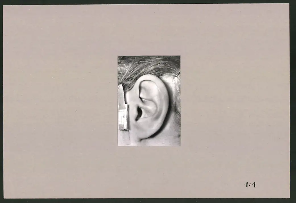Fotoalbum 28 Privat-Fotografien, Johanna Häcker, Anatomie und Mikrofotografie, Totenkopf, Memento mori 9
