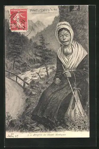 AK Mont-Dauphin, Atrophiée des Hautes Montagnes, Behinderte mit Kropf