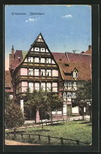 AK Hildesheim, Pfeilerhaus