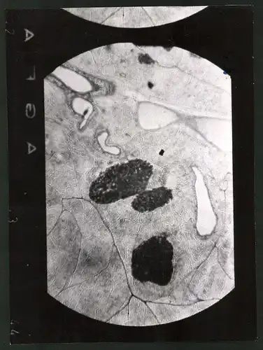 Fotografie Helmut Raddatz, Berlin, Diabetes Zentralinstitut Gerhardt Katsch, Karlsburg, Mikroaufnahme Bauchspeicheldrüse
