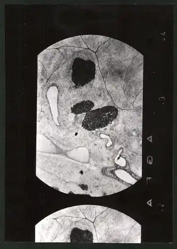 Fotografie Helmut Raddatz, Berlin, Diabetes Zentralinstitut Gerhardt Katsch in Karlsburg, Pankreas Mikro-Aufnahme