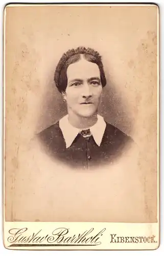 Fotografie Gustav Bartholi, Eibenstock, Portrait Dame mit Hasenscharte im Kleid mit Spitzenkragen