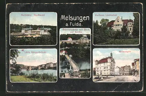 AK Melsungen a. Fulda, Heilstätte Stadtwald, Kurhaus Lindenlust, Ortsansicht