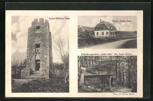 AK Adenau, Hohe Acht mit Hotel zur hohen Acht, Blockhaus Erfrischungsstation, Kaiser Wilhelm Turm