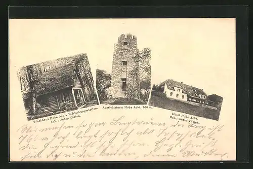 AK Adenau, Hotel Hohe Acht, Aussichtsturm und Blockhaus