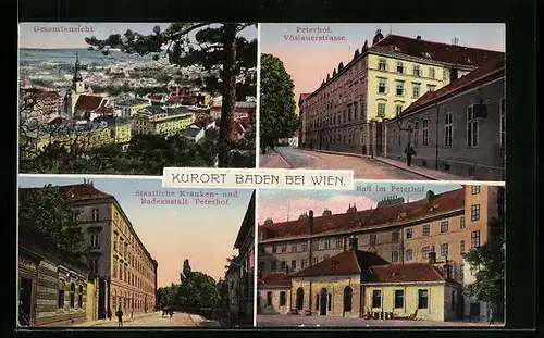 AK Baden b. Wien, Petershof an der Vöslauerstrasse, Staatliche Kranken- und Badeanstalt Peterhof