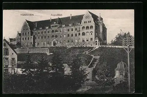 AK Tübingen, Augenklinik