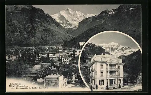 AK Interlaken, Hotel Alpenblick mit Lagerbierkeller Bräuerei Horn