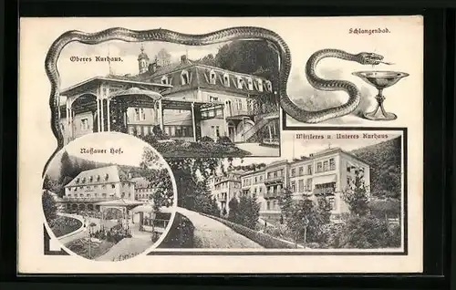 AK Schlangenbad, Oberes Krankenhaus, Nassauer Hof