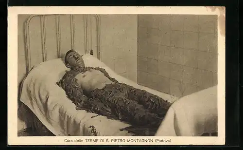 AK Padova, Cura delle Terme di S. Pietro Montagoni, Mann nimmt ein Schlammbad