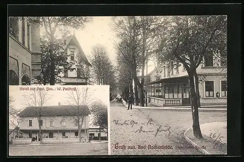 AK Bad Rothenfelde, Frankfurter Strasse mit Hotel zur Post