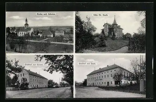AK Schönau a. d. Eigen, Gasthof zur Sonne, Villa Dr. Suck, Kirche und Schulen