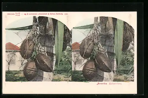 Stereo-AK Kokosnüsse an einem Baum in Amerika