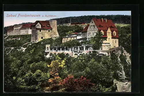 AK Frankenhausen a. Kyffh., Ortspartie mit Hotel Frankenburg