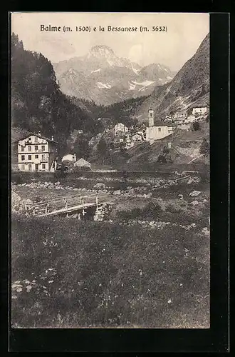 AK Balme, Villaggio e la Bessanese