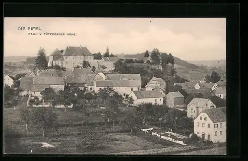 AK Daun /Eifel, Sicht auf die Pützborner Höhe