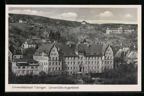 AK Tübingen, Universitäts-Augenklinik