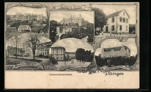 AK Tübingen, Sechs Ansichten der Universitätskliniken