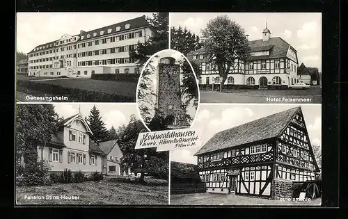 AK Hochwaldhausen, Turm, Hotel Felsenmeer, Teufelsmühle, Pension Stirm-Heuser